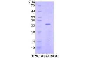 SDS-PAGE (SDS) image for NME/NM23 Nucleoside Diphosphate Kinase 3 (NME3) (AA 2-169) protein (His tag) (ABIN1878948)