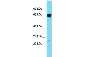 Western Blotting (WB) image for anti-Intraflagellar Transport Protein 74 Homolog (IFT74) (Middle Region) antibody (ABIN2490303) (IFT74 antibody  (Middle Region))