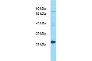 WB Suggested Anti-MED20 Antibody Titration: 1. (MED20 antibody  (Middle Region))