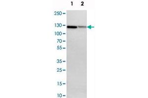 Western blot analysis of cell lysates with NFKB2 polyclonal antibody  at 1:250-1:500 dilution.