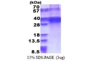 SDS-PAGE (SDS) image for Four and A Half LIM Domains 3 (FHL3) (AA 1-280) protein (His tag) (ABIN5853348)