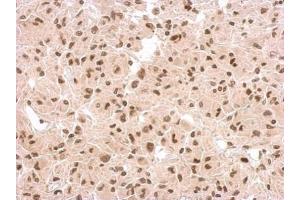 Immunohistochemistry (IHC) image for anti-Tumor Protein P53 (TP53) (N-Term) antibody (ABIN2854816)