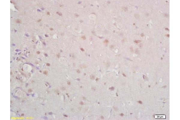 TMEFF1 antibody  (AA 65-160)