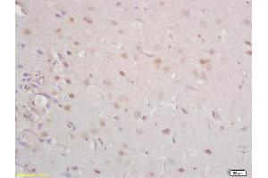 Formalin-fixed and paraffin embedded rat brain labeled with Anti Tomoregulin-1 Polyclonal Antibody, Unconjugated (ABIN762686) at 1:200 followed by conjugation to the secondary antibody and DAB staining (TMEFF1 antibody  (AA 65-160))