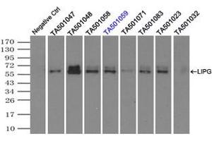 Image no. 2 for anti-Lipase, Endothelial (LIPG) antibody (ABIN1499176)