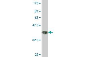 Western Blot detection against Immunogen (37. (RNF151 antibody  (AA 68-173))