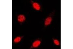 Immunofluorescent analysis of RB1 staining in HuvEc cells. (Retinoblastoma 1 antibody  (C-Term))
