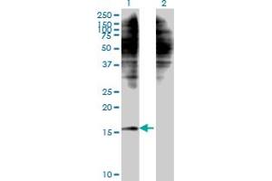 Western Blotting (WB) image for anti-C1D Nuclear Receptor Corepressor (C1D) (AA 1-141) antibody (ABIN523839)