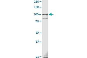 TLR9 monoclonal antibody (M04), clone 3B7 Western Blot analysis of TLR9 expression in IMR-32 . (TLR9 antibody  (AA 99-215))