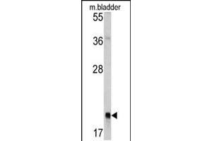 Western blot analysis of RAB13 antibody in mouse bladder tissue lysates (35ug/lane) (RAB13 antibody  (AA 109-137))