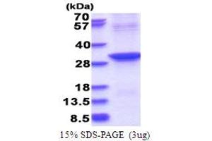 Abhydrolase Domain Containing 12B (ABHD12B) (AA 1-255) protein (His tag)