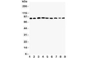 Western blot testing of Plakophilin 2 antibody and Lane 1:  rat heart;  2: human placenta;  3: (r) brain;  4: (r) intestine;  5: (h) HeLa;  6: (h) Jurkat;  7: (h) 293T;  8: (h) MCF-7;  9: (h) U87 lysate.