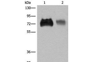 Western blot analysis of Jurkat and A375 cell lysates using SLC3A2 Polyclonal Antibody at dilution of 1:450 (SLC3A2 antibody)