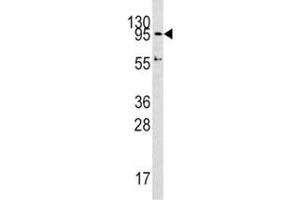 Western blot analysis of Dnmt3a antibody and HepG2 lysate. (DNMT3A antibody  (AA 723-752))