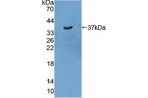 Western blot analysis of recombinant Human STATH. (STATH antibody  (AA 1-62))