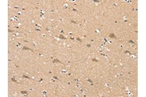 The image on the left is immunohistochemistry of paraffin-embedded Human brain tissue using ABIN7192347(SGPL1 Antibody) at dilution 1/25, on the right is treated with synthetic peptide. (SGPL1 antibody)