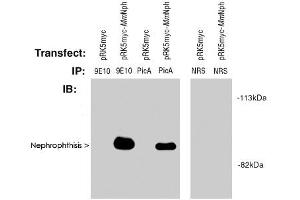 Western blot of Nephrophthisis (pic) polyclonal antibody  used at 2! (NPHP1 antibody  (AA 612-691))