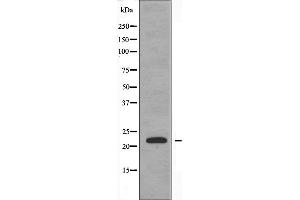 Western blot analysis of extracts from HeLa cells using PPIF antibody. (PPIF antibody  (Internal Region))