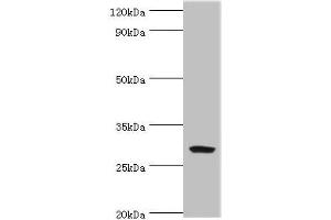Western blot All lanes: Spindlin-2B antibody at 4 μg/mL + Mouse gastric tissue Secondary Goat polyclonal to rabbit IgG at 1/10000 dilution Predicted band size: 29 kDa Observed band size: 29 kDa (Spindlin 2B antibody  (AA 1-258))