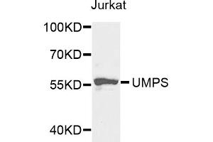 Western blot analysis of extracts of Jurkat cells, using UMPS antibody. (UMPS antibody)