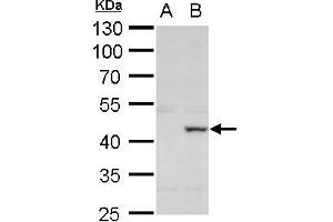 WB Image XRCC3 antibody detects XRCC3 protein by western blot analysis.