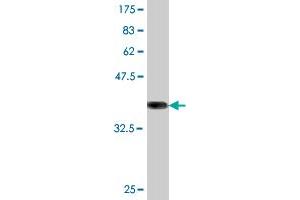 Western Blot detection against Immunogen (36. (ATG5 antibody  (AA 176-275))