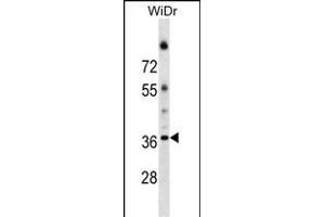 ALG5 Antibody (Center) (ABIN1538598 and ABIN2849400) western blot analysis in WiDr cell line lysates (35 μg/lane). (ALG5 antibody  (AA 74-100))