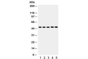 Western blot testing of 1) rat liver, 2) mouse liver, 3) human SMMC, 4) RH35 and 5) HepG2 lysate with YB1 antibody. (YBX1 antibody)