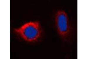 Immunofluorescent analysis of Calnexin (pS583) staining in HeLa cells. (Calnexin antibody  (C-Term, pSer583))