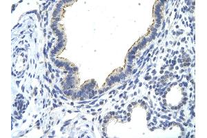 Rabbit Anti-DDX21 antibody   Paraffin Embedded Tissue: Human Lung cell Cellular Data: cilia of renal tubule Antibody Concentration: 4. (DDX21 antibody  (N-Term))