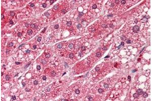 Human Adrenal (formalin-fixed, paraffin-embedded) stained with PPP1CA antibody ABIN364338 at 5 ug/ml followed by biotinylated anti-mouse IgG secondary antibody ABIN481714, alkaline phosphatase-streptavidin and chromogen.