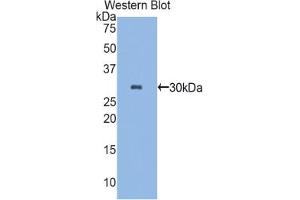 Western blot analysis of the recombinant protein. (Plastin 3 antibody  (AA 234-475))