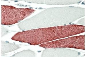 AP32711PU-N TNNI3 Antibody staining of paraffin embedded Human Skeletal Muscle at 5 µg/ml. (TNNT3 antibody)
