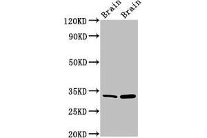 Western Blot Positive WB detected in: Mouse brain tissue, Rat brain tissue All lanes: HAX1 antibody at 1. (HAX1 antibody  (AA 2-250))