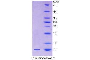 SDS-PAGE (SDS) image for Oncomodulin (OCM) (AA 1-109) protein (His tag) (ABIN1878844) (Oncomodulin Protein (OCM) (AA 1-109) (His tag))