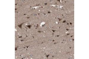 Immunohistochemical staining of human cerebral cortex with KANSL1 polyclonal antibody  shows strong cytoplasmic and nuclear positivity in neuronal cells.
