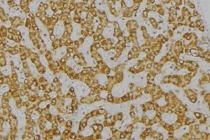 ABIN6276770 at 1/100 staining Mouse liver tissue by IHC-P. (DPYD antibody  (Internal Region))