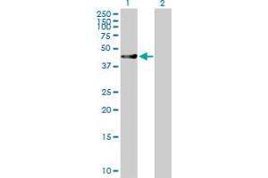 Western Blot analysis of RUSC1 expression in transfected 293T cell line by RUSC1 MaxPab polyclonal antibody. (RUSC1 antibody  (AA 1-433))
