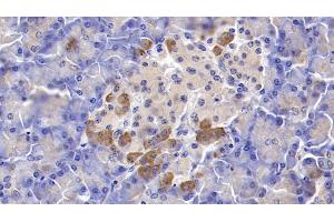 Immunohistochemistry (IHC) image for anti-Tumor Necrosis Factor Receptor Superfamily, Member 11b (TNFRSF11B) (AA 1-196) antibody (ABIN7431044)