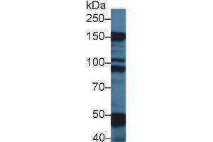 Western Blot; Sample: Rat Skeletal muscle lysate; Primary Ab: 1µg/ml Rabbit Anti-Mouse MYBPC1 Antibody Second Ab: 0. (MYBPC1 antibody  (AA 1-277))