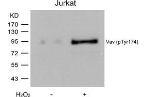 Western blot analysis of extracts from Jurkat cells untreated or treated with H2O2 using Vav(Phospho-Tyr174) Antibody. (VAV1 antibody  (pTyr174))