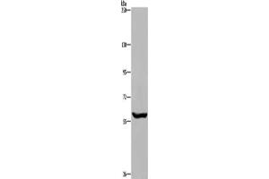 Gel: 6 % SDS-PAGE, Lysate: 40 μg, Lane: Raji cells, Primary antibody: ABIN7191360(MAGEL2 Antibody) at dilution 1/250, Secondary antibody: Goat anti rabbit IgG at 1/8000 dilution, Exposure time: 5 minutes (MAGE-Like 2 antibody)