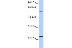 WB Suggested Anti-SYNGR2 Antibody Titration:  0.