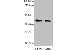 Western blot All lanes: GPR17 antibody at 10 μg/mL Lane 1: Mouse brain tissue Lane 2: Human high value serum Secondary Goat polyclonal to rabbit IgG at 1/10000 dilution Predicted band size: 41, 38 kDa Observed band size: 41 kDa