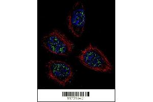 Confocal immunofluorescent analysis of PNN Antibody (Center) (ABIN655502 and ABIN2845018) with NCI- cell followed by Alexa Fluor 488-conjugated goat anti-rabbit lgG (green). (PNN antibody  (AA 209-239))