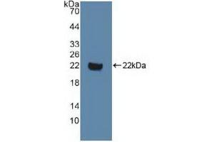 Detection of Recombinant DVL1, Human using Polyclonal Antibody to Dishevelled, Dsh Homolog 1 (DVL1) (DVL1 antibody  (AA 150-285))