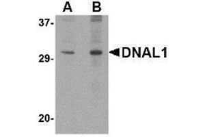 Western blot analysis of DNAL1 in 3T3 cell lysate with AP30294PU-N DNAL1 antibody at (A) 1 and (B) 2 μg/ml. (DNAL1 antibody  (C-Term))