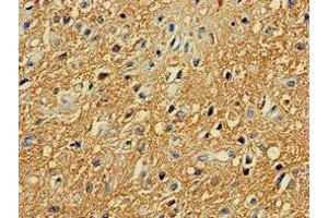 Immunohistochemistry (IHC) image for anti-Protein Kinase, CAMP-Dependent, Regulatory, Type II, alpha (PRKAR2A) (AA 43-205), (Regulatory Subunit) antibody (ABIN7146620)