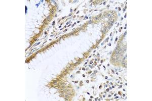 Immunohistochemistry of paraffin-embedded human stomach using TMEM189 antibody (ABIN6134447, ABIN6149262, ABIN6149263 and ABIN6224423) at dilution of 1:100 (40x lens).
