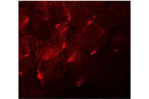 Immunofluorescence of TMEM38A in mouse skeletal muscle tissue with TMEM38A antibody at 20 μg/ml. (TMEM38A antibody  (C-Term))
